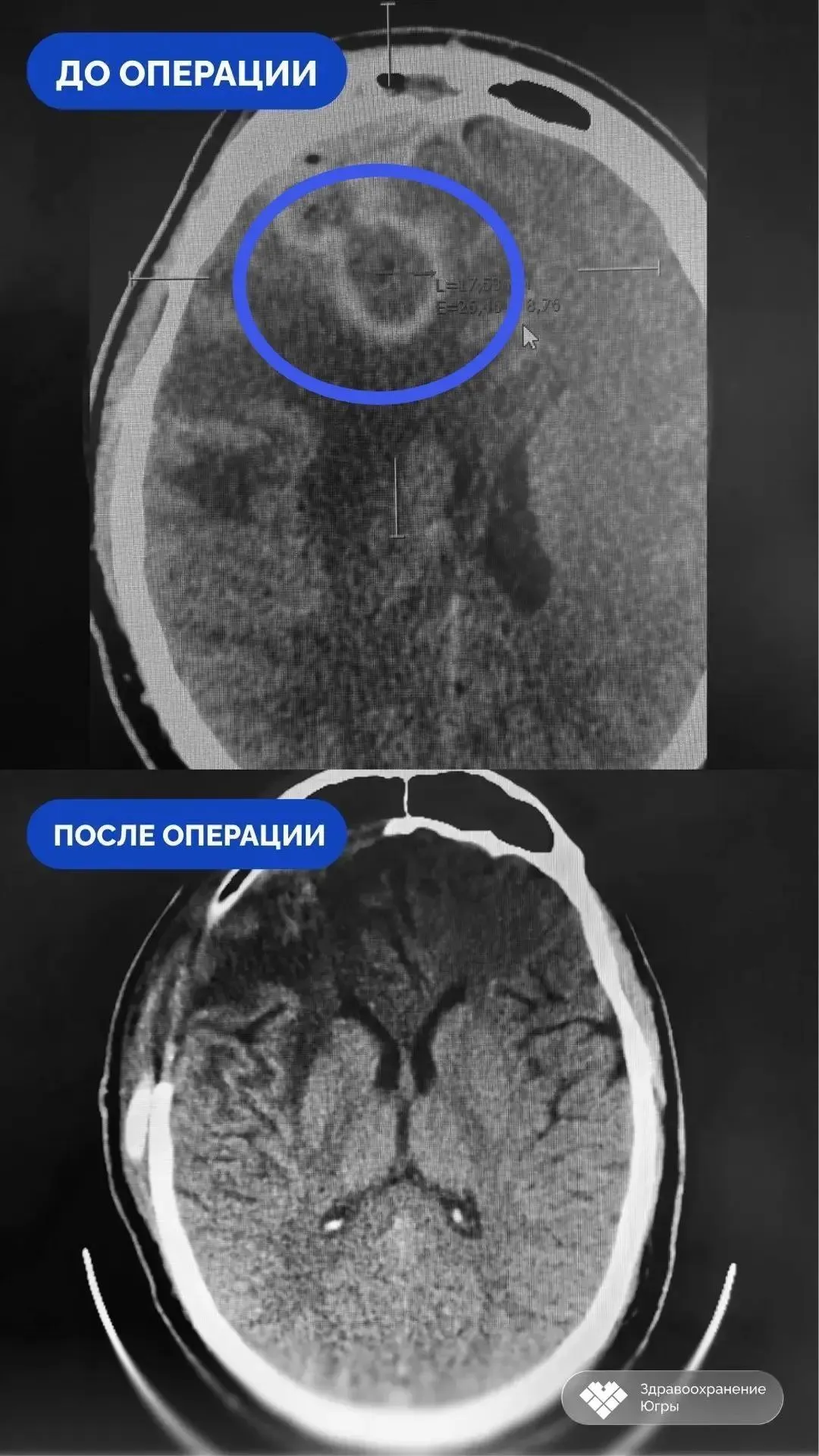 Сургутский травмцентр