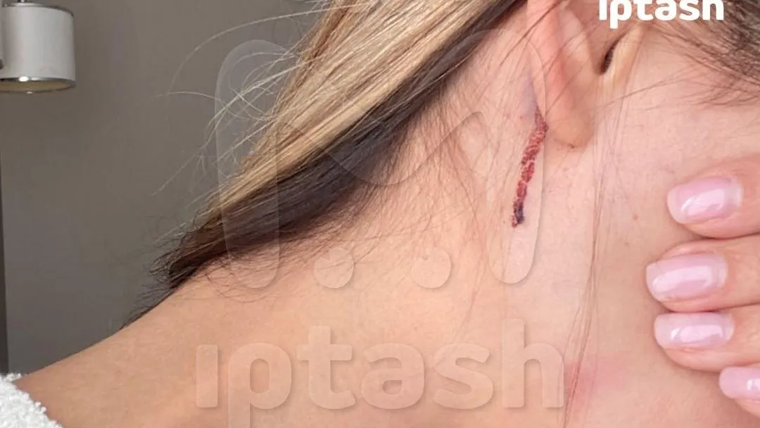 Телеграм-канал Mash Iptash